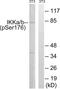 Component Of Inhibitor Of Nuclear Factor Kappa B Kinase Complex antibody, LS-C199102, Lifespan Biosciences, Western Blot image 