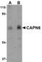 Calpain 6 antibody, LS-B4597, Lifespan Biosciences, Western Blot image 