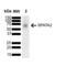 Sodium Voltage-Gated Channel Beta Subunit 2 antibody, SMC-485D-DY405, StressMarq, Western Blot image 