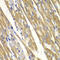Tyrosinase antibody, LS-C331387, Lifespan Biosciences, Immunohistochemistry paraffin image 