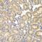 Proteasome 26S Subunit, Non-ATPase 9 antibody, GTX54558, GeneTex, Immunohistochemistry paraffin image 