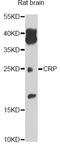 C-Reactive Protein antibody, MBS125389, MyBioSource, Western Blot image 