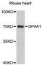 Glycosylphosphatidylinositol Anchor Attachment 1 antibody, LS-C748870, Lifespan Biosciences, Western Blot image 