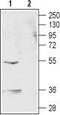 Gamma-Aminobutyric Acid Type A Receptor Rho2 Subunit antibody, TA328814, Origene, Western Blot image 