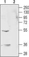 Gamma-Aminobutyric Acid Type A Receptor Rho2 Subunit antibody, TA328814, Origene, Western Blot image 