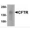 CF Transmembrane Conductance Regulator antibody, TA349025, Origene, Western Blot image 