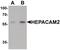 HEPACAM Family Member 2 antibody, PA5-34480, Invitrogen Antibodies, Western Blot image 