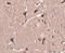 Zinc Finger Protein 667 antibody, NBP1-77357, Novus Biologicals, Immunohistochemistry frozen image 