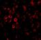 SCO Cytochrome C Oxidase Assembly Protein 2 antibody, NBP1-77274, Novus Biologicals, Immunofluorescence image 