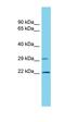 Vacuolar Protein Sorting 25 Homolog antibody, orb331100, Biorbyt, Western Blot image 