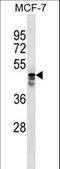 Adaptor Related Protein Complex 5 Subunit Mu 1 antibody, LS-C158330, Lifespan Biosciences, Western Blot image 