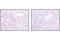 Arachidonate 5-Lipoxygenase antibody, 3289S, Cell Signaling Technology, Immunohistochemistry paraffin image 