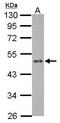 Zinc Finger Protein 71 antibody, GTX116553, GeneTex, Western Blot image 