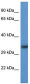 Acyl-CoA Binding Domain Containing 6 antibody, TA342938, Origene, Western Blot image 