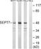 Septin-7 antibody, A30759, Boster Biological Technology, Western Blot image 