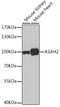 N-Acylsphingosine Amidohydrolase 2 antibody, GTX55519, GeneTex, Western Blot image 