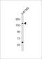 ATPase Plasma Membrane Ca2+ Transporting 3 antibody, M05418, Boster Biological Technology, Western Blot image 