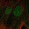 PHD Finger Protein 11 antibody, PA5-64967, Invitrogen Antibodies, Immunofluorescence image 