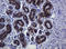 Cadherin 1 antibody, LS-C175443, Lifespan Biosciences, Immunohistochemistry paraffin image 