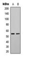 Serum/Glucocorticoid Regulated Kinase 1 antibody, orb393161, Biorbyt, Western Blot image 