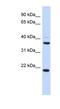 Transmembrane Protein 74 antibody, NBP1-60092, Novus Biologicals, Western Blot image 