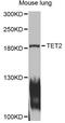 Tet Methylcytosine Dioxygenase 2 antibody, MBS127841, MyBioSource, Western Blot image 