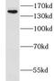 Chloride Channel Accessory 2 antibody, FNab01742, FineTest, Western Blot image 