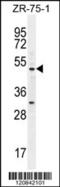 Myocyte Enhancer Factor 2D antibody, 56-005, ProSci, Western Blot image 