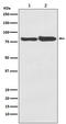 Acyl-CoA Synthetase Long Chain Family Member 4 antibody, M04372-1, Boster Biological Technology, Western Blot image 