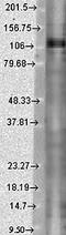 Potassium Voltage-Gated Channel Subfamily C Member 1 antibody, orb67403, Biorbyt, Western Blot image 