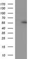 Ankyrin repeat and MYND domain-containing protein 2 antibody, LS-C788554, Lifespan Biosciences, Western Blot image 