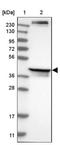 Mitochondrial Fission Regulator 1 antibody, NBP1-84480, Novus Biologicals, Western Blot image 