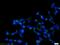 Secretory Carrier Membrane Protein 2 antibody, 15119-1-AP, Proteintech Group, Immunofluorescence image 