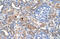 Polypeptide N-Acetylgalactosaminyltransferase 6 antibody, 30-240, ProSci, Enzyme Linked Immunosorbent Assay image 