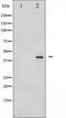 Histone Deacetylase 8 antibody, TA325525, Origene, Western Blot image 