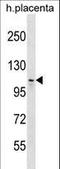 MMS19 nucleotide excision repair protein homolog antibody, LS-C158156, Lifespan Biosciences, Western Blot image 