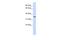 TRNA-YW Synthesizing Protein 5 antibody, A13546, Boster Biological Technology, Western Blot image 