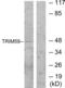 Tripartite Motif Containing 59 antibody, LS-B8422, Lifespan Biosciences, Western Blot image 