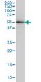 Solute Carrier Family 29 Member 4 antibody, H00222962-M03, Novus Biologicals, Western Blot image 