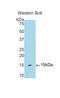 Polymeric Immunoglobulin Receptor antibody, LS-C298991, Lifespan Biosciences, Western Blot image 