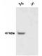 Interleukin 1 Receptor Accessory Protein Like 1 antibody, orb234172, Biorbyt, Western Blot image 
