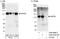 Protein Phosphatase 6 Regulatory Subunit 2 antibody, A300-970A, Bethyl Labs, Western Blot image 