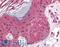 Programmed Cell Death 1 antibody, LS-B540, Lifespan Biosciences, Immunohistochemistry paraffin image 