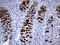 Trefoil Factor 3 antibody, M01738-1, Boster Biological Technology, Immunohistochemistry paraffin image 