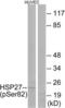 Heat Shock Protein Family B (Small) Member 1 antibody, LS-C117379, Lifespan Biosciences, Western Blot image 