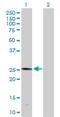 Phospholipase A2 Group IVD antibody, H00283748-D01P, Novus Biologicals, Western Blot image 