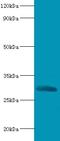 Chymotrypsin Like Elastase 2A antibody, LS-C318916, Lifespan Biosciences, Western Blot image 