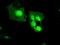 MX Dynamin Like GTPase 1 antibody, NBP1-47859, Novus Biologicals, Immunocytochemistry image 