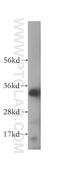 Retinal short-chain dehydrogenase/reductase 2 antibody, 17301-1-AP, Proteintech Group, Western Blot image 