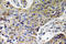 ATP Synthase Membrane Subunit F antibody, LS-C199772, Lifespan Biosciences, Immunohistochemistry paraffin image 